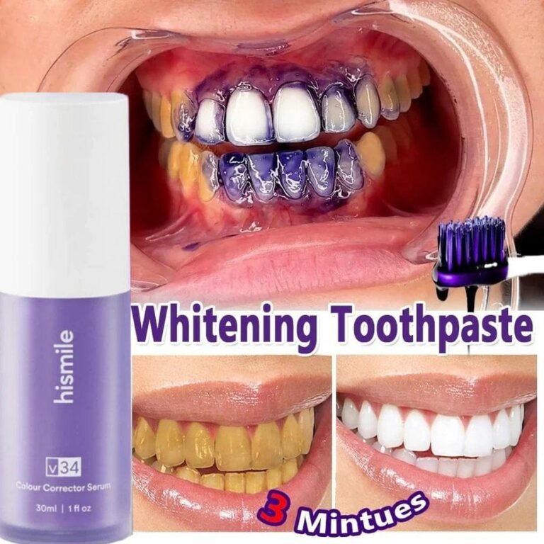 Whiter teeth, instant results