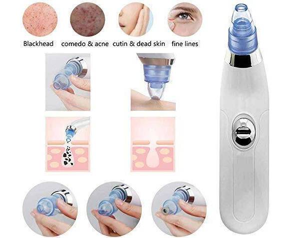 Smart Blackhead Remover