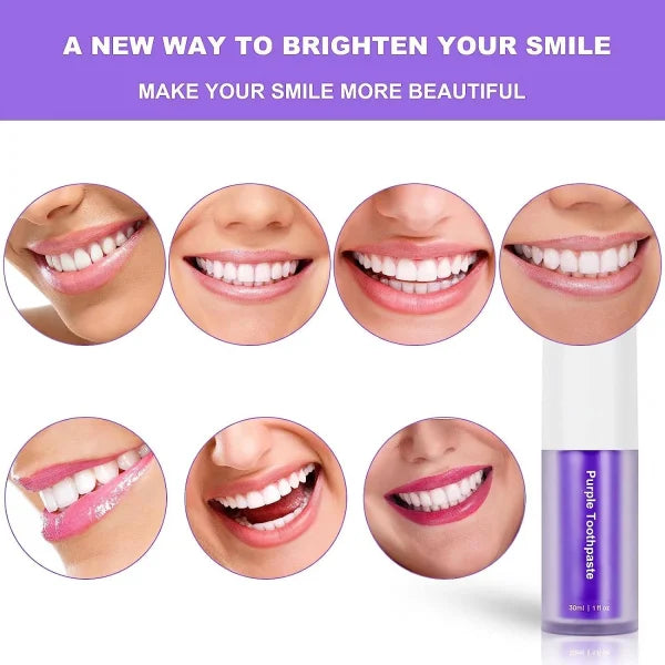 Whiter teeth, instant results
